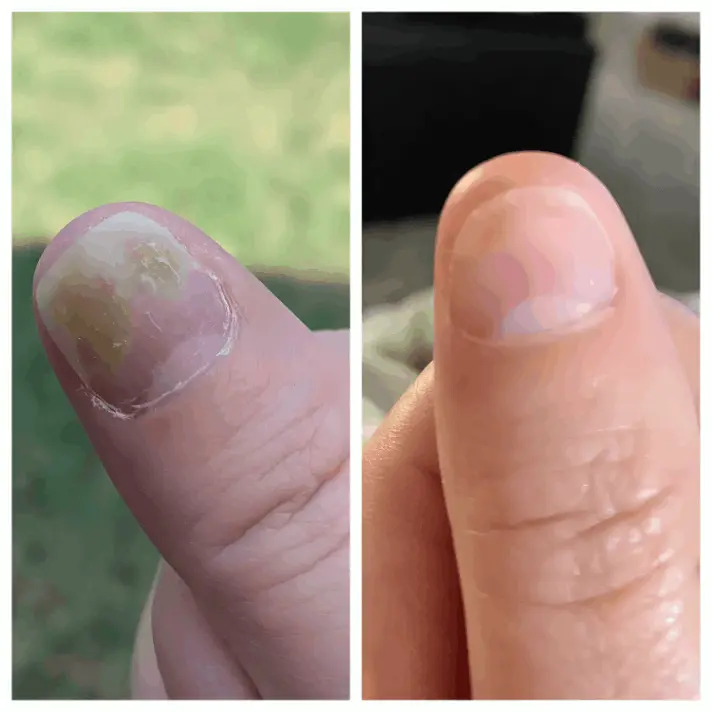 Fungabeam User Review